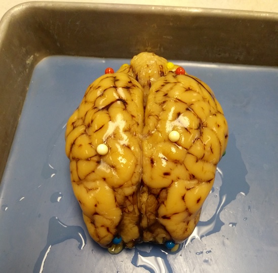 Brain Pic
