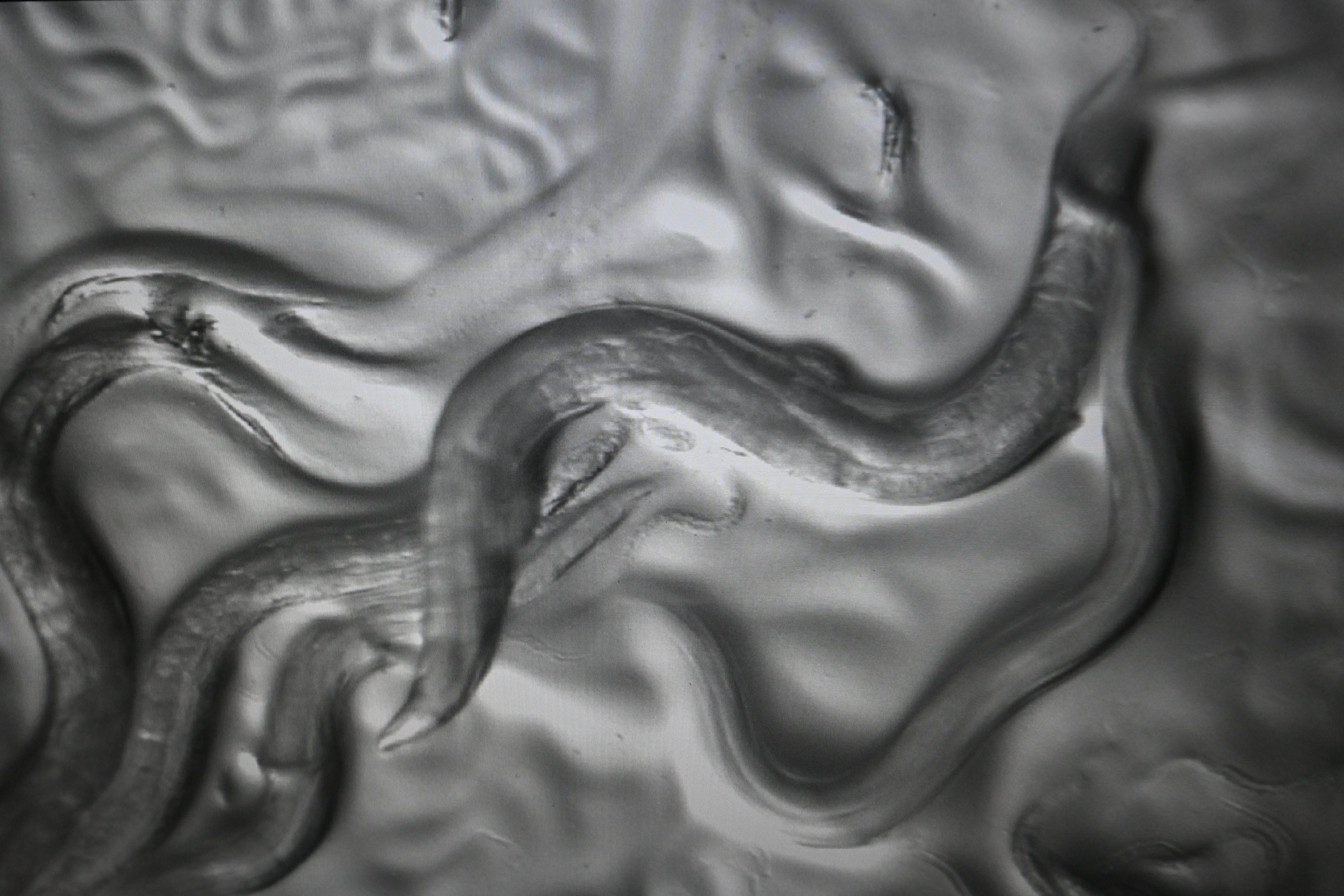 roundworm closeup