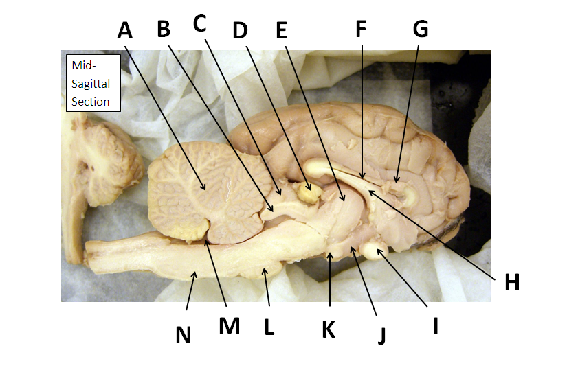 Mid-Sagittal Section